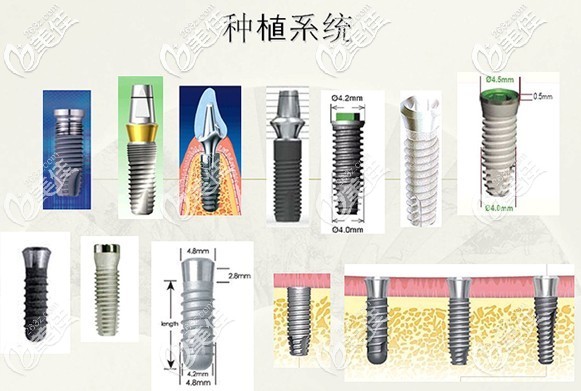 國產(chǎn)和進(jìn)口的各品牌種植體示意圖 國產(chǎn)和進(jìn)口的各品牌種植體示意圖