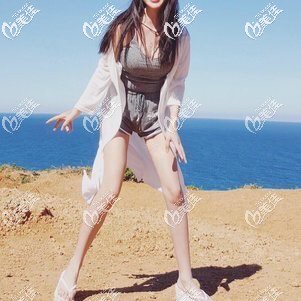 雖然找寧波壹加壹郭光燁做大腿吸脂瘦了不少，但以后也要注意飲食習慣