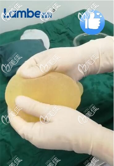 十年前的藍(lán)貝假體