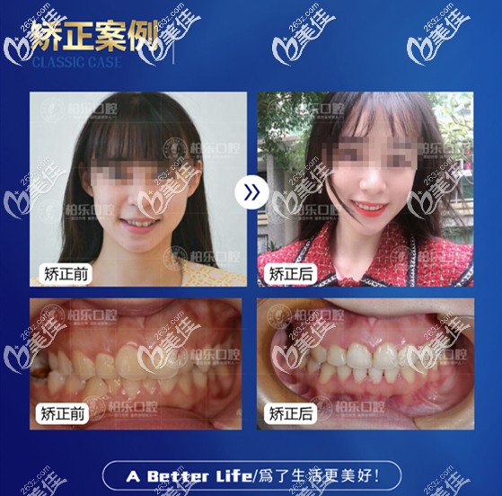 陳世隱醫(yī)生矯正案例