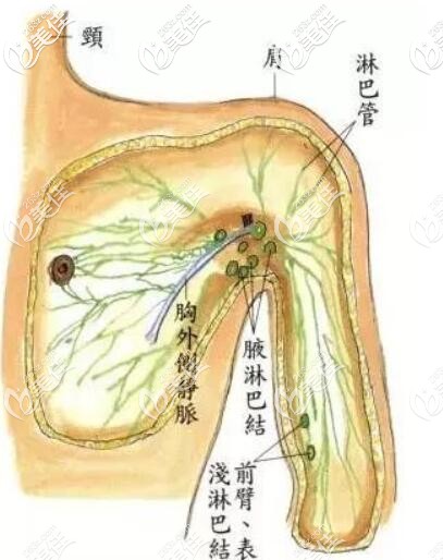 副乳的危害 副乳的危害