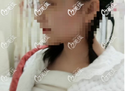 做假體隆胸<span style= 做假體隆胸<span style=