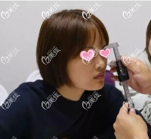 隆鼻術(shù)前肖征剛院長(zhǎng)面診