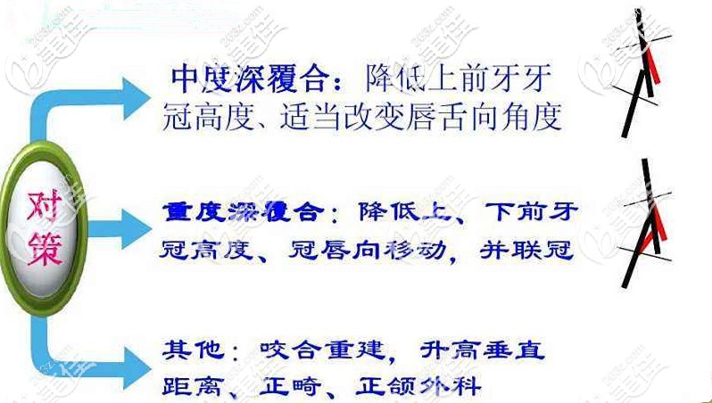 深覆合矯正時的對策