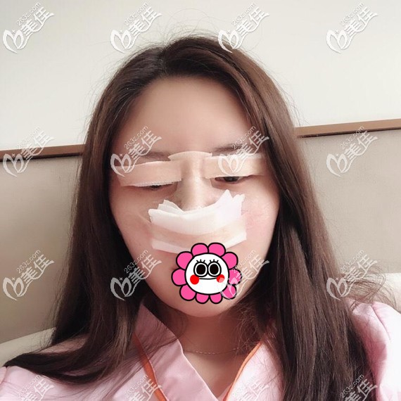 眼鼻整形術(shù)后即刻