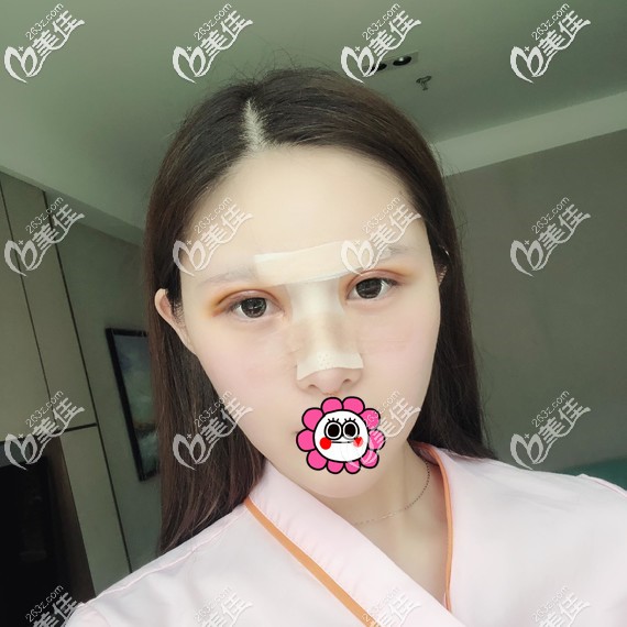 恢復(fù)7天到醫(yī)院拆線