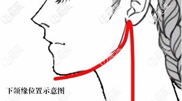 下頜緣位置示意圖