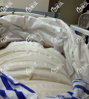 第二天還在病床上 第二天還在病床上