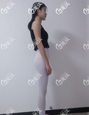 瘦了很多 瘦了很多