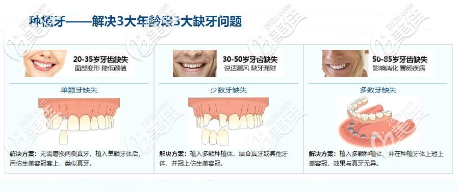 種植牙優(yōu)勢(shì)介紹圖 種植牙優(yōu)勢(shì)介紹圖