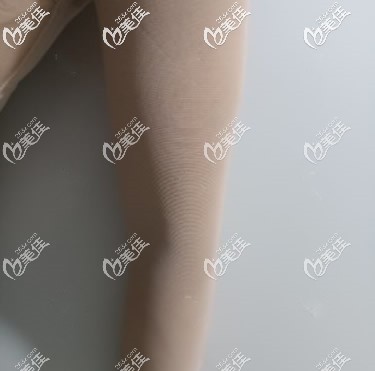 蘭州時(shí)光逯巖給我做手臂環(huán)吸第1天