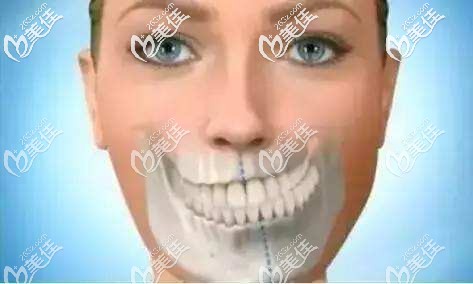 牙齒偏頜通過牙套能矯正嘛