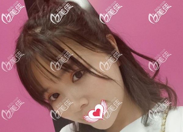 面部吸脂一個月輪廓已經(jīng)顯示出來了 面部吸脂一個月輪廓已經(jīng)顯示出來了