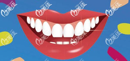 “一日得”種植牙的特點(diǎn)
