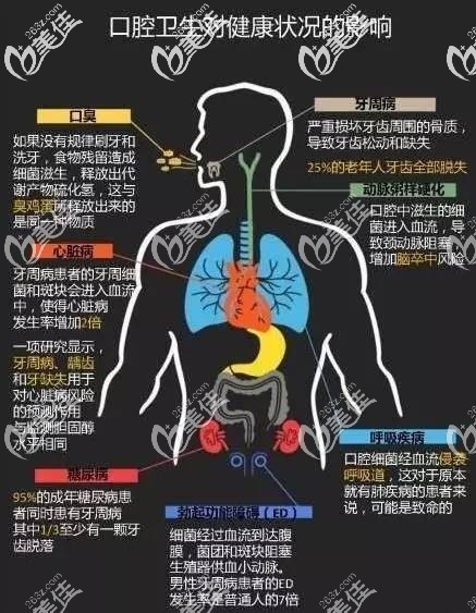 口腔衛(wèi)生對身體健康狀況的影響 口腔衛(wèi)生對身體健康狀況的影響