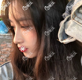 為了做鼻子，我仔細(xì)研究了韓士生科型號HN214和215有啥區(qū)別和215是幾段