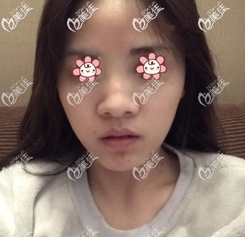 我原來的鼻子 我原來的鼻子