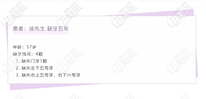 徐叔牙齒缺失病例