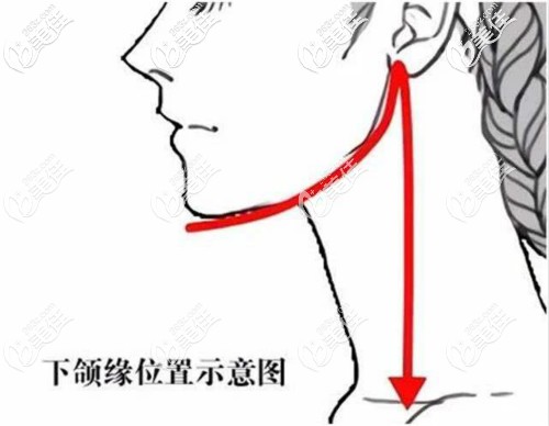 下頜緣位置示意圖