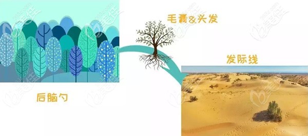 植發(fā)手術(shù)和植樹(shù)類似