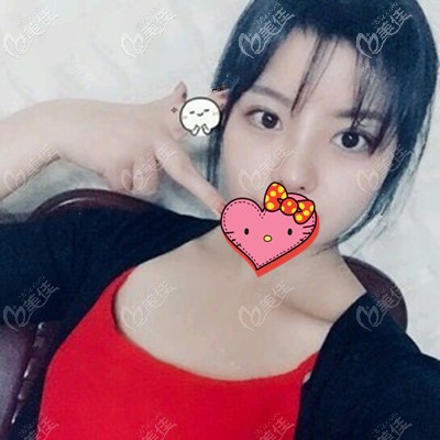 術(shù)后半個月效果分享