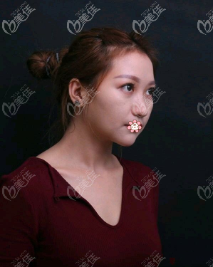 側(cè)面更不好看 側(cè)面更不好看