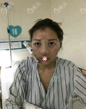 畢勝醫(yī)生給我手術(shù)完第三天 畢勝醫(yī)生給我手術(shù)完第三天