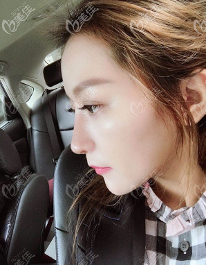 重慶隆鼻好的醫(yī)生是哪個(gè) 重慶隆鼻好的醫(yī)生是哪個(gè)