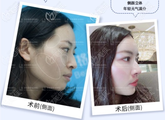 側(cè)臉立體感強(qiáng) 側(cè)臉立體感強(qiáng)