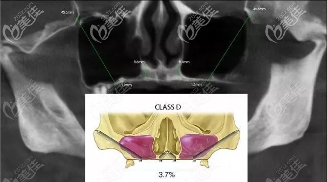 舉例:顧客術(shù)前口腔的評(píng)估結(jié)果 舉例:顧客術(shù)前口腔的評(píng)估結(jié)果