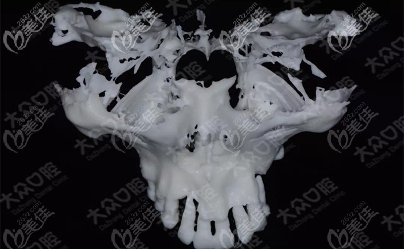 顧客上頜骨的模型