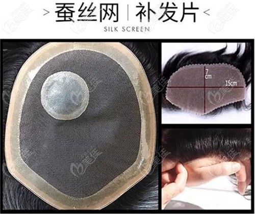 蠶絲網(wǎng)補(bǔ)發(fā)片示意圖 蠶絲網(wǎng)補(bǔ)發(fā)片示意圖