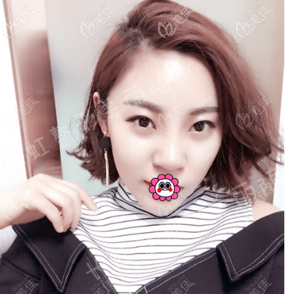 徐學(xué)東給我做隆鼻第10天了