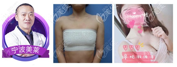美萊整形做隆胸實(shí)例 美萊整形做隆胸實(shí)例