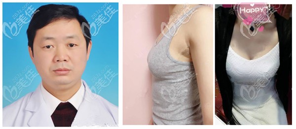 <i data-id='bf5df4e8-bc56-4dd3-9b95-aff3b8c16dff' style='display:none;'></i>醫(yī)療美容診所隆胸實(shí)例 <i data-id='bf5df4e8-bc56-4dd3-9b95-aff3b8c16dff' style='display:none;'></i>醫(yī)療美容診所隆胸實(shí)例