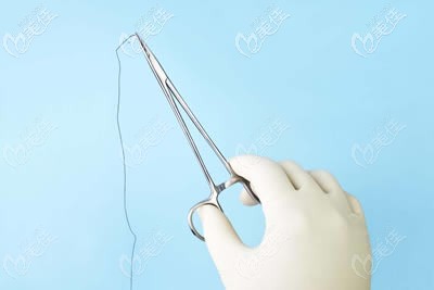 去除縫針留下的疤痕方法介紹 去除縫針留下的疤痕方法介紹