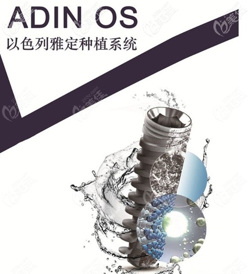 以色列雅定adin種植體 以色列雅定adin種植體