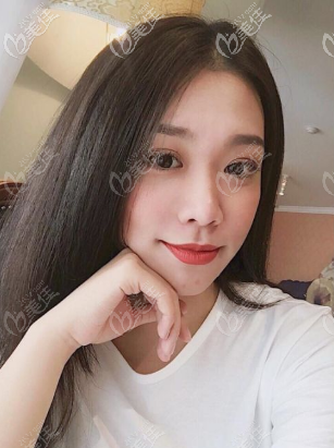 半個月以后看到效果了 半個月以后看到效果了