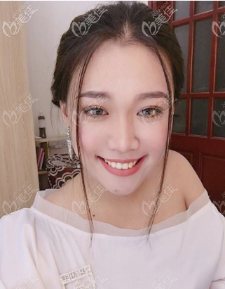 重慶華美打玻尿酸怎么樣 重慶華美打玻尿酸怎么樣