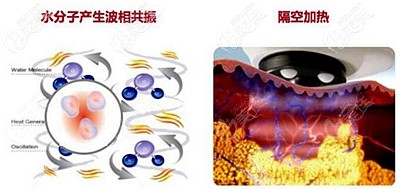 熱拉提具有消脂的作用