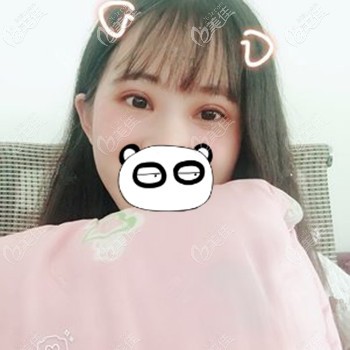 做眼綜合后上瞼下垂的情況得到了改善