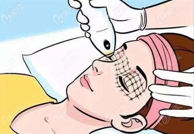 眼周熱瑪吉的部位 眼周熱瑪吉的部位