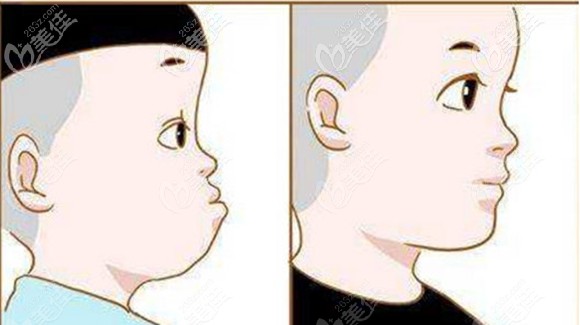 齒科正畸醫(yī)生的溫馨提醒 齒科正畸醫(yī)生的溫馨提醒