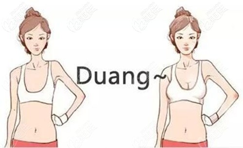 做完假體隆胸術(shù)后效果