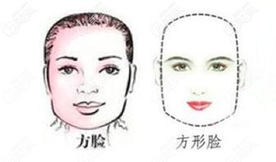方臉型真的就是要靠磨骨嘛？
