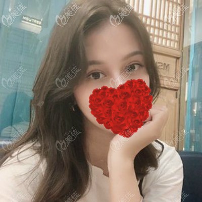 雙眼皮割的又寬又深,找武漢專門修復雙眼皮的醫(yī)生項利姣做了寬降窄修復,效果自然且價格便宜