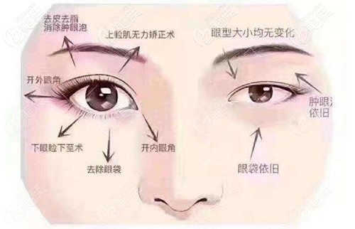 眼綜合包括哪些項(xiàng)目