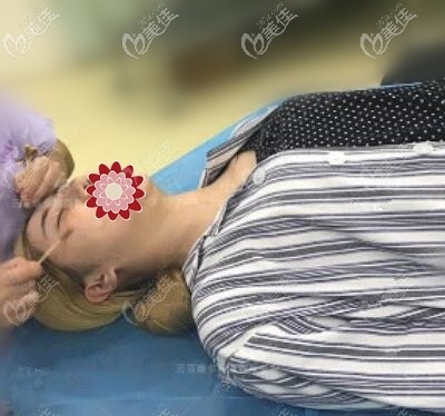 祛眼袋術(shù)前消毒 祛眼袋術(shù)前消毒