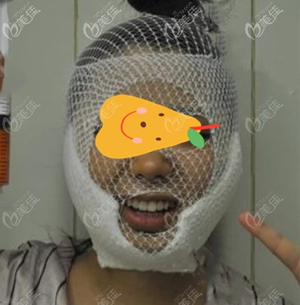 蘭州夢(mèng)想趙梅霞給我做面部吸脂第二天