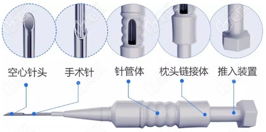 毛發(fā)移植中的微針植發(fā)技術(shù) 毛發(fā)移植中的微針植發(fā)技術(shù)